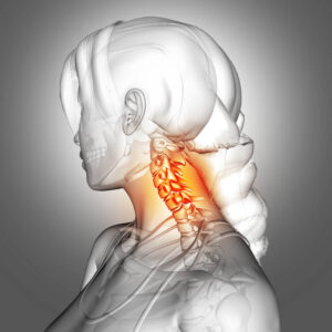 Rappresentazione anatomica della cervicale infiammata, dolore e rigidità articolare